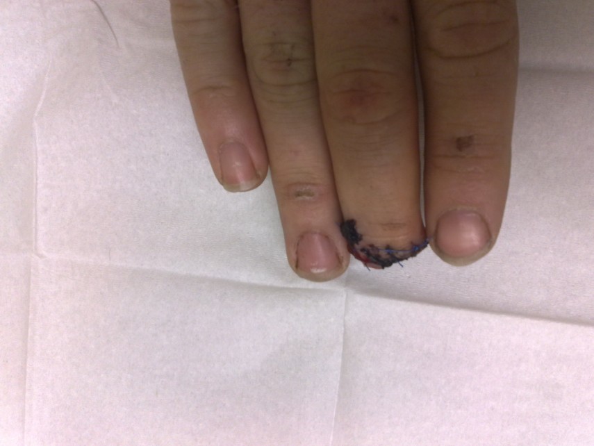 Part of what the build has cost me, lol - Others Beware, don't stick your hand near a running engine